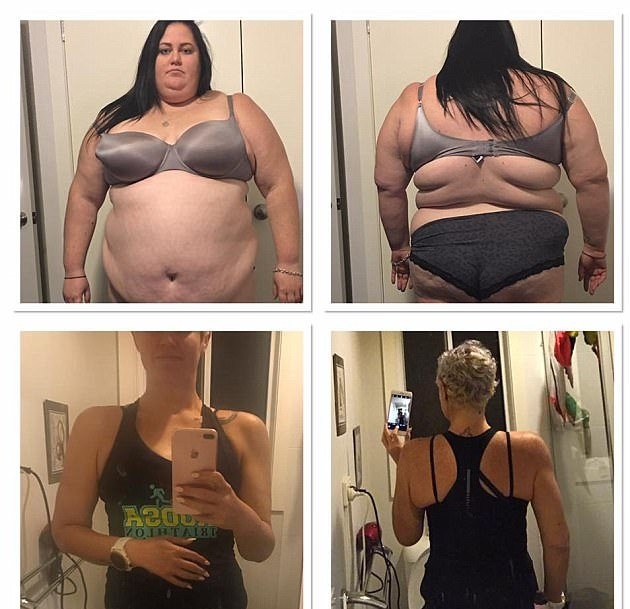 giảm cân để giữ mạng sống ảnh 1 giam can de giu mang song anh 1