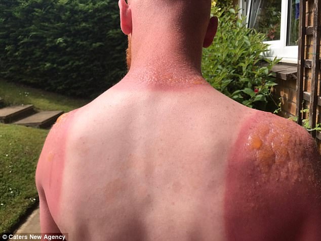 Bong cap do 2 vi coi tran lam viec ngoai troi nang hinh anh