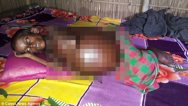 Khong co tien phau thuat, be 7 tuoi nam cho chet hinh anh