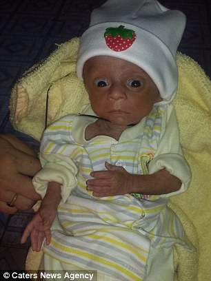 não úng thủy ảnh 1 nao ung thuy anh 1