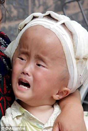 não úng thủy ảnh 2 nao ung thuy anh 2