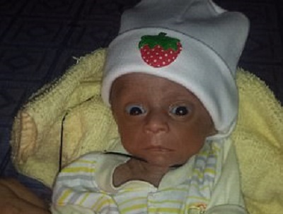 Cha me quyet phau thuat cho con du bac si lac dau hinh anh