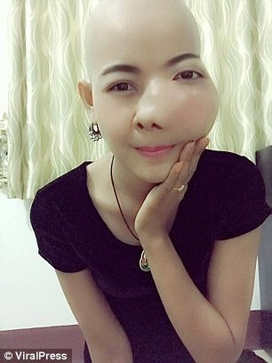 co gai Thai Lan bi ung thu mieng anh 2