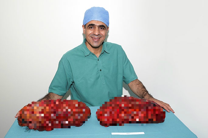 Cat bo qua than nang hon 4 kg duoc ghi vao sach Guinness hinh anh