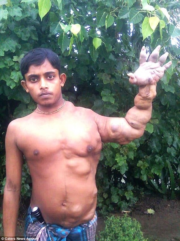 Gan 20 nam song trong so hai vi co the bien dang do u hiem anh 1