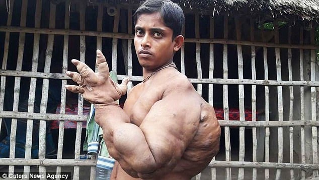 Gan 20 nam song trong so hai vi co the bien dang do mac benh hiem hinh anh