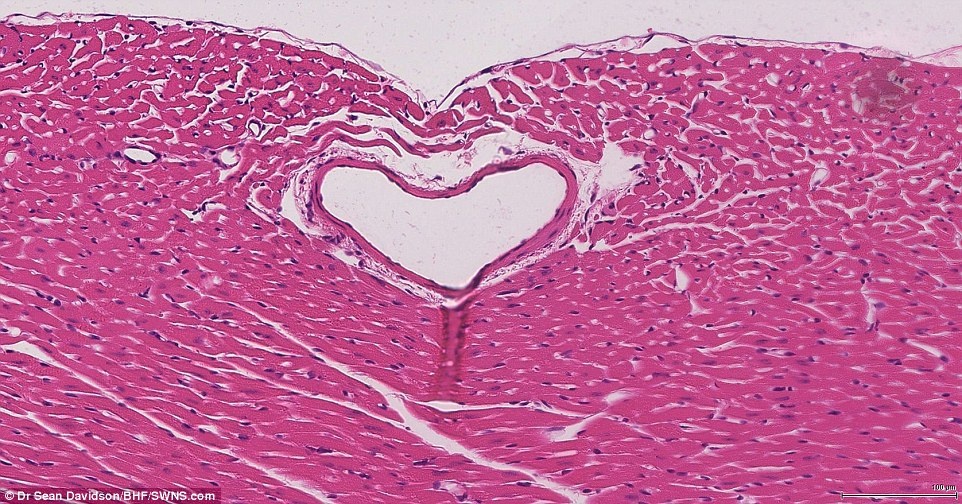 anh dep ve trai tim anh 9