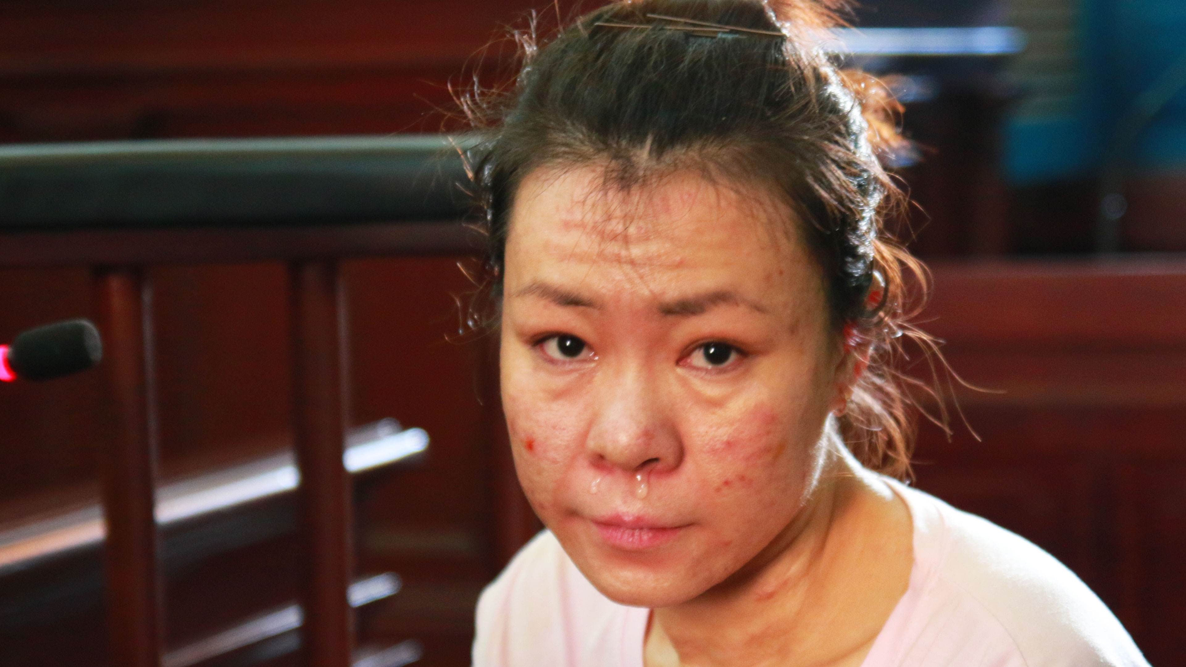 Nguoi phu nu luy tinh dot  ban trai tre tuoi duoc chuyen toi danh hinh anh