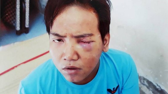 Bao ve dan pho sat hai be trai 6 tuoi o Sai Gon bi tam than phan liet hinh anh