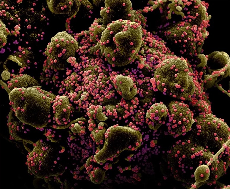 Ly do virus nCoV kho bi tieu diet hoan toan hinh anh