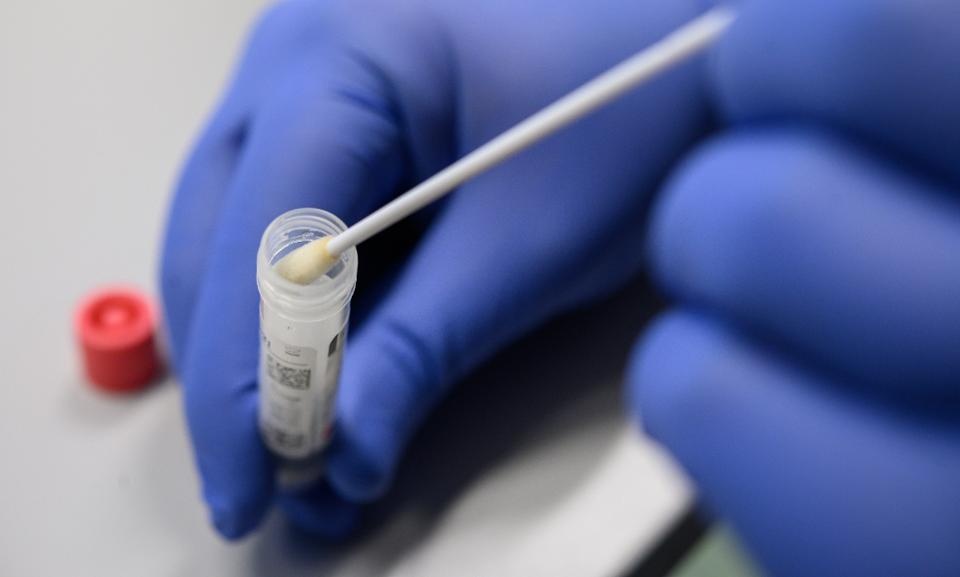 Ai co the mien dich voi Covid-19? anh 2