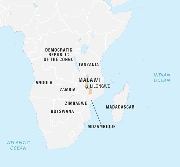 người bạch tạng ở châu Phi ảnh 1 nguoi bach tang o chau Phi anh 1