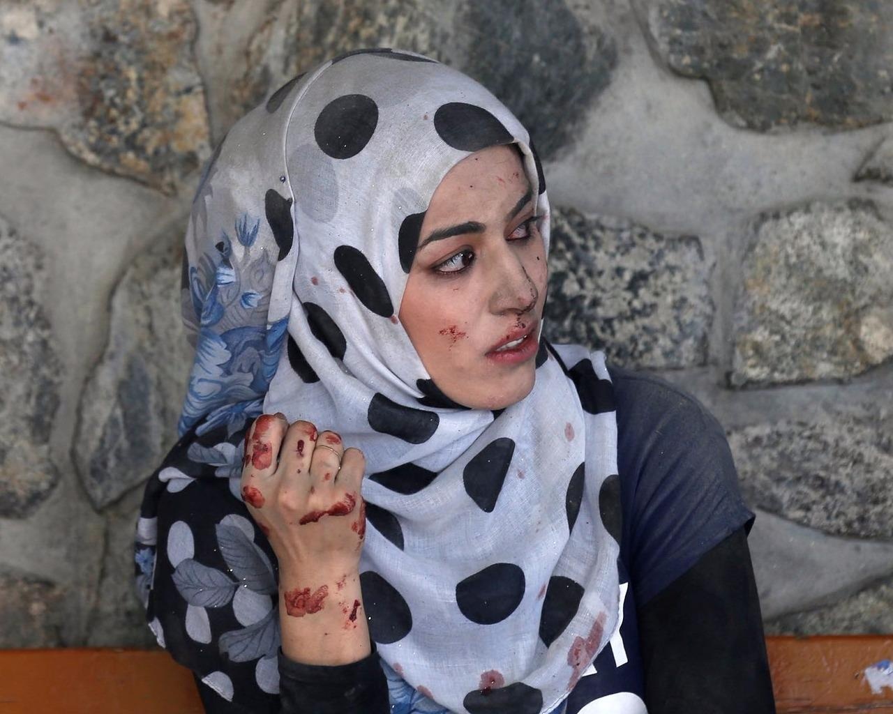 Anh mat so hai cua co gai Afghanistan vao top anh tuan hinh anh