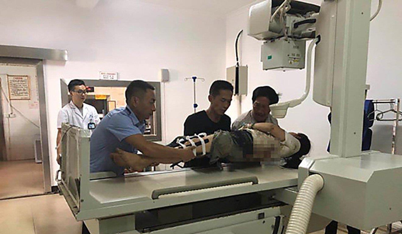 Dua con di tieu ven duong, du khach TQ bi voi quat trong thuong hinh anh