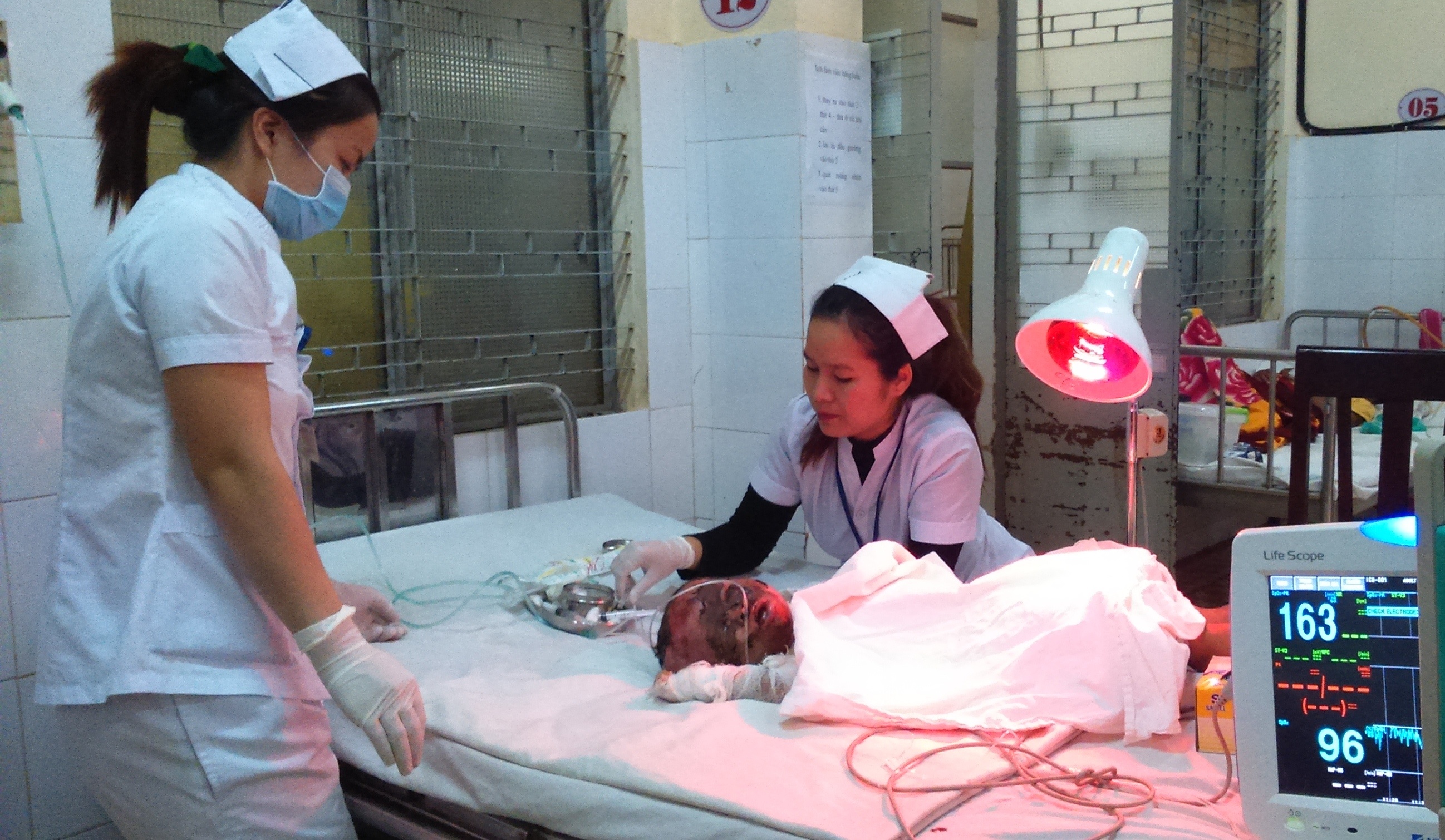 Me de chai xang gan lua, con 13 thang tuoi bong nang hinh anh