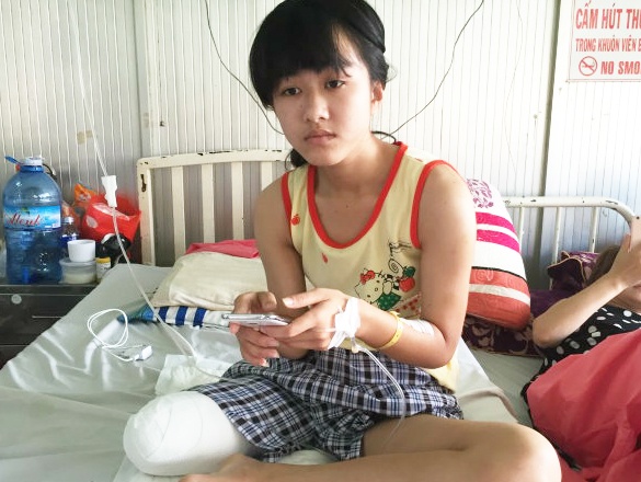 Nu sinh 15 tuoi bi cua chan co the kien bac si hinh anh