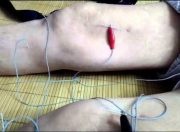 Cu ba 73 tuoi tu vong tai phong kham chui hinh anh