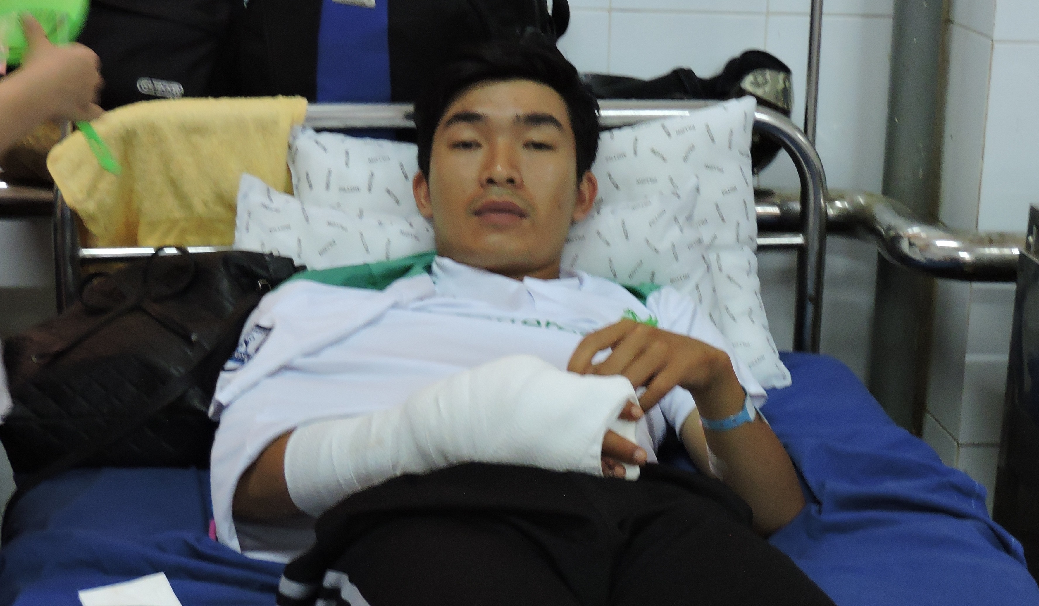 Thieu uy cong an bi con do chem dut 2 gan tay hinh anh