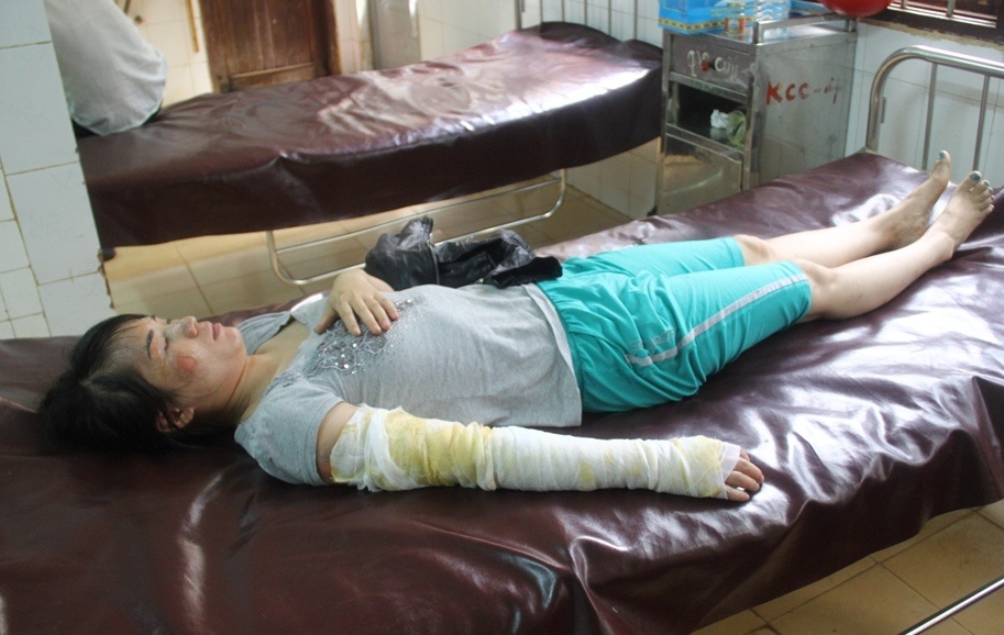 Vo di lam dep ve nha bi chong tuoi nuoc soi len nguoi hinh anh