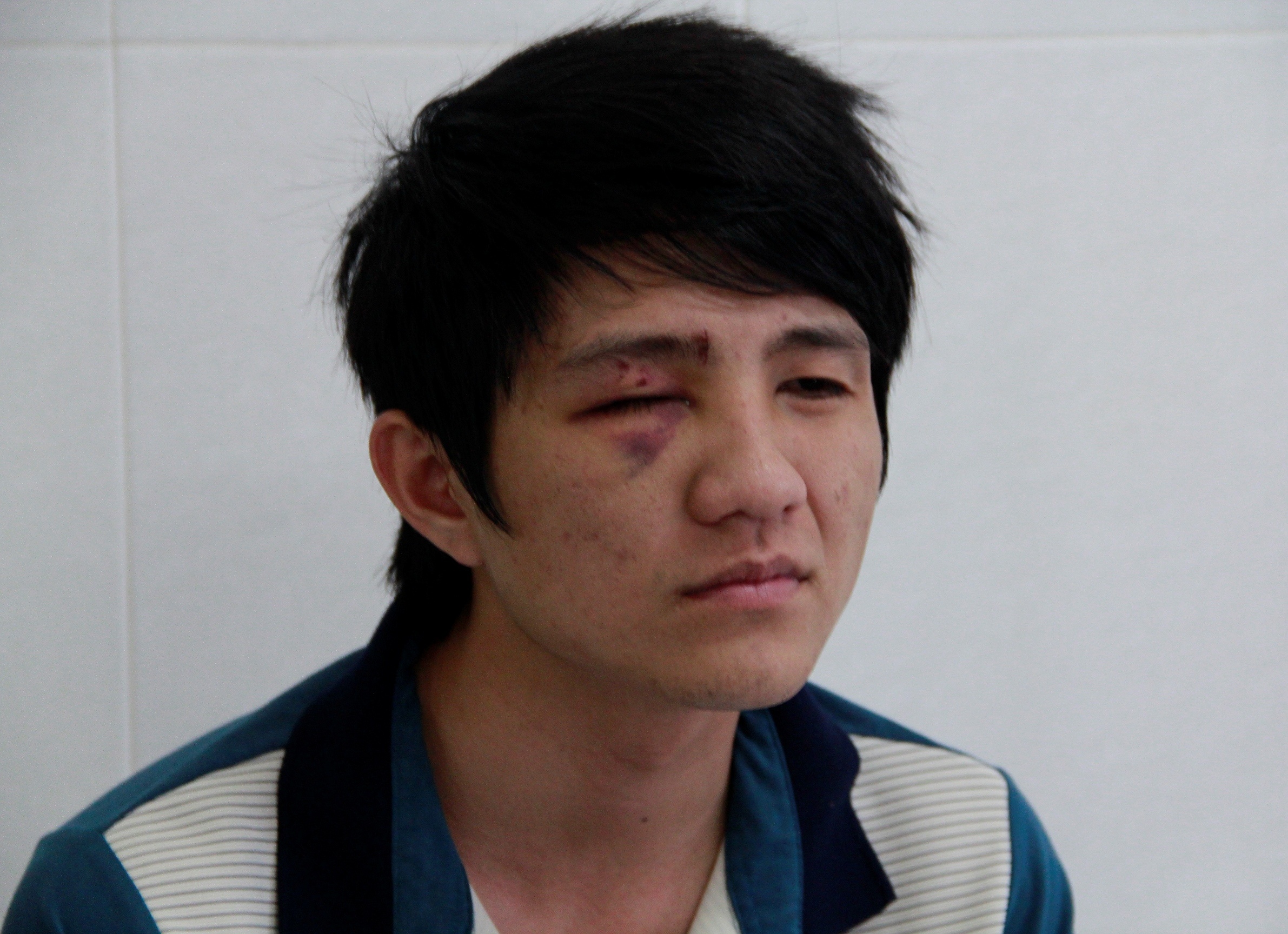 Nguoi di duong bam mat do 'dap mat vao gay' CSGT hinh anh