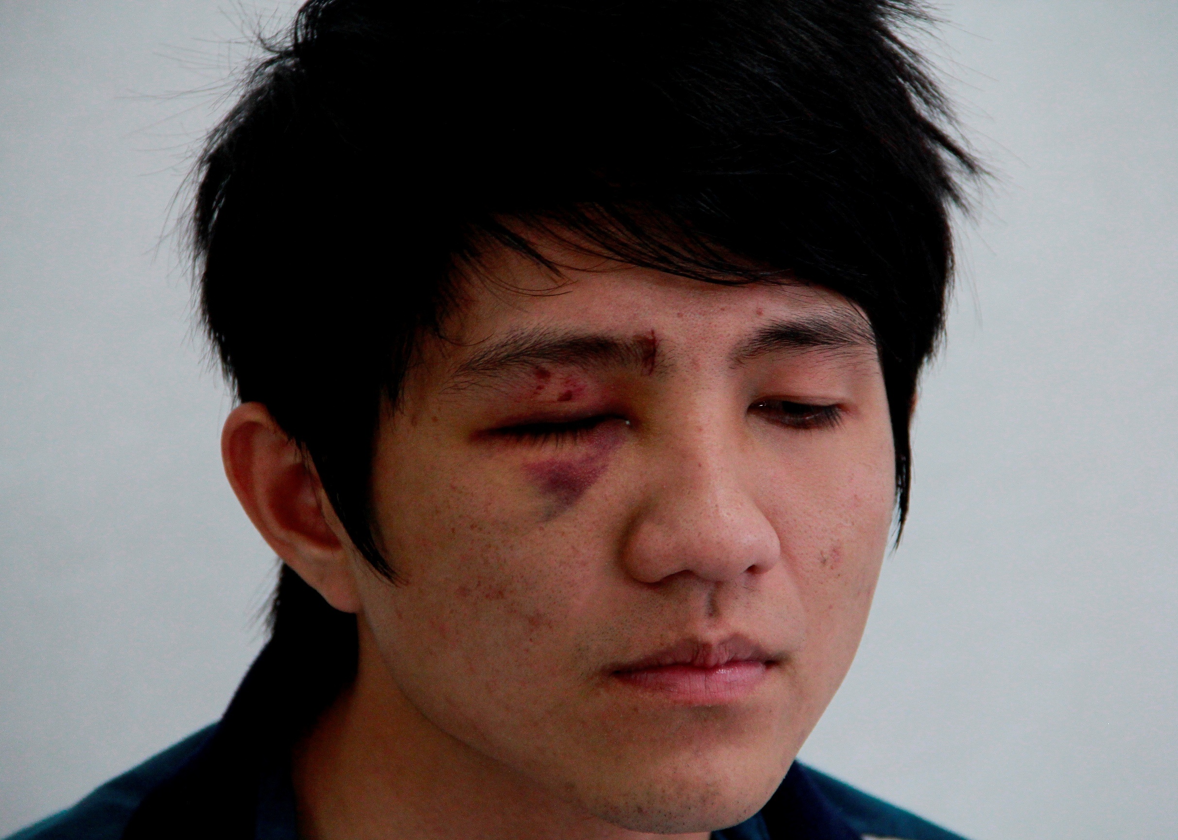 Cong an Dak Lak xac minh vu 'dap mat vao gay' hinh anh