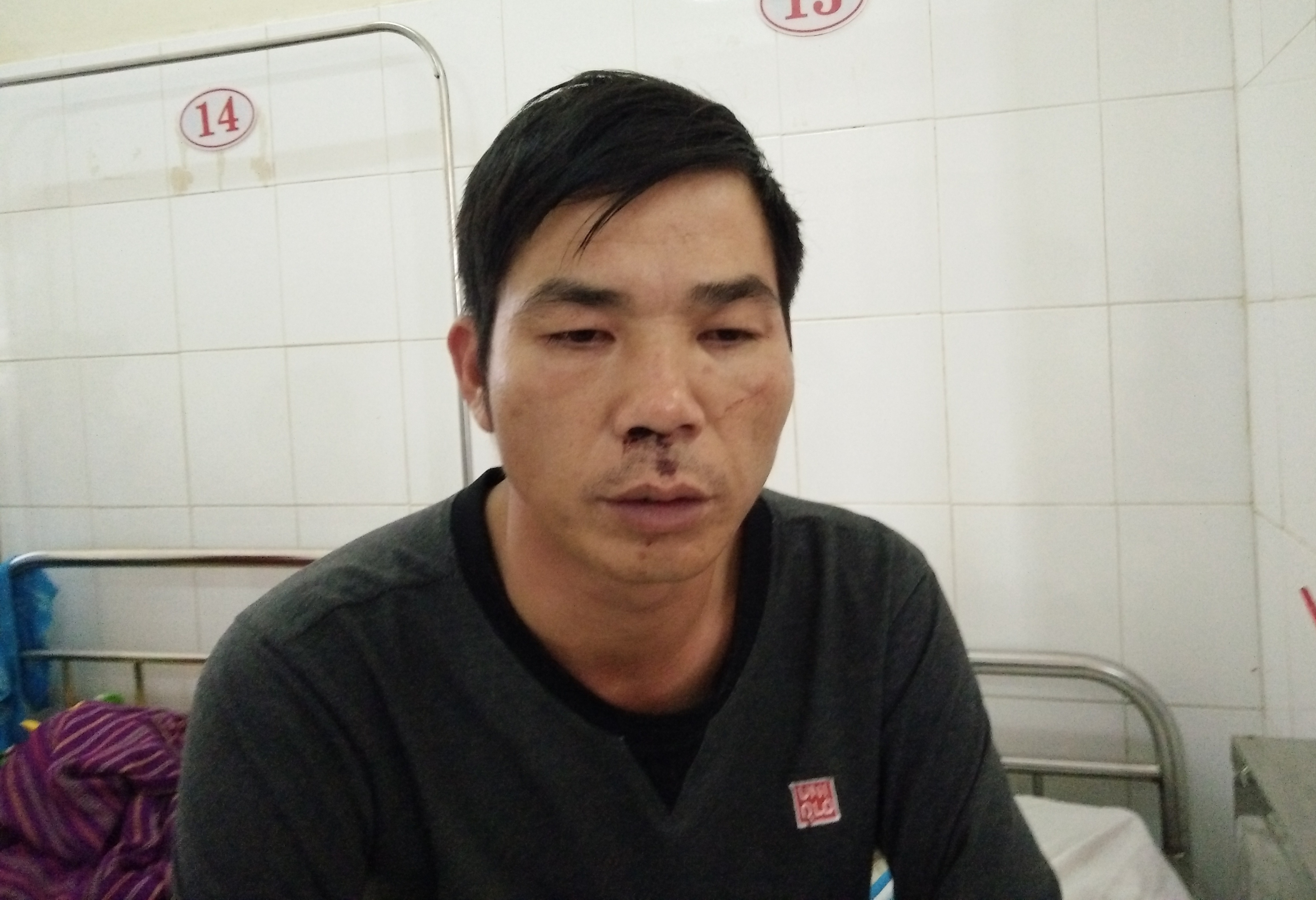 Tai xe xa khach bi doi thu tan cong anh 1