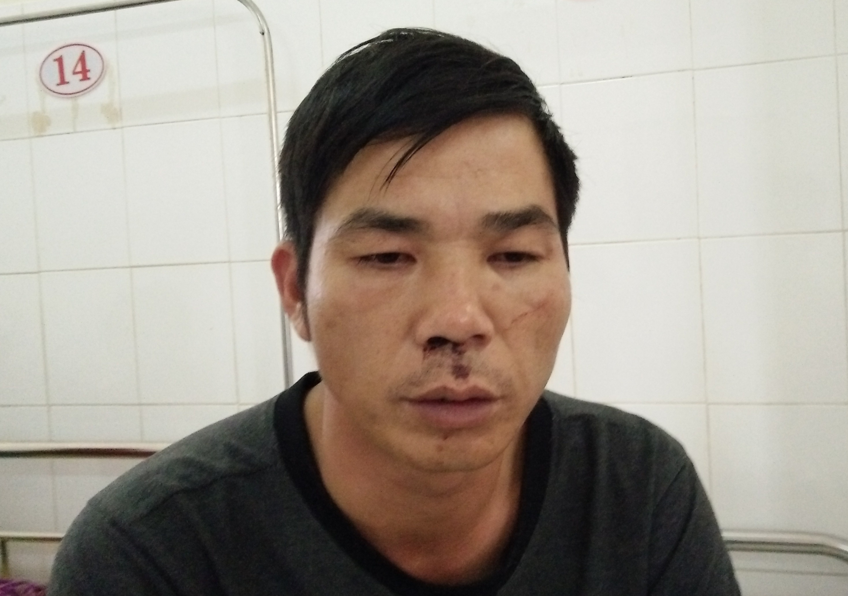 Tai xe dang lai xe bi tan cong, 20 hanh khach bo chay hinh anh