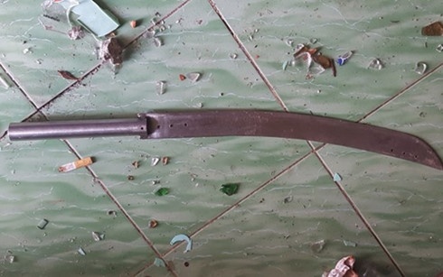 Di dam cuoi, nguoi dan ong 54 tuoi bi chem trong thuong hinh anh