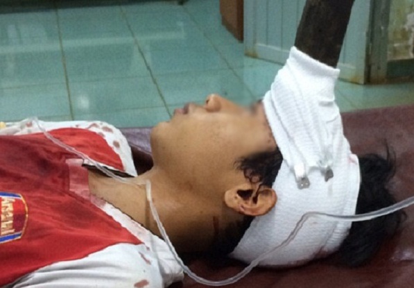 Be trai 12 tuoi bi dao cam giua tran khi dua voi em hinh anh