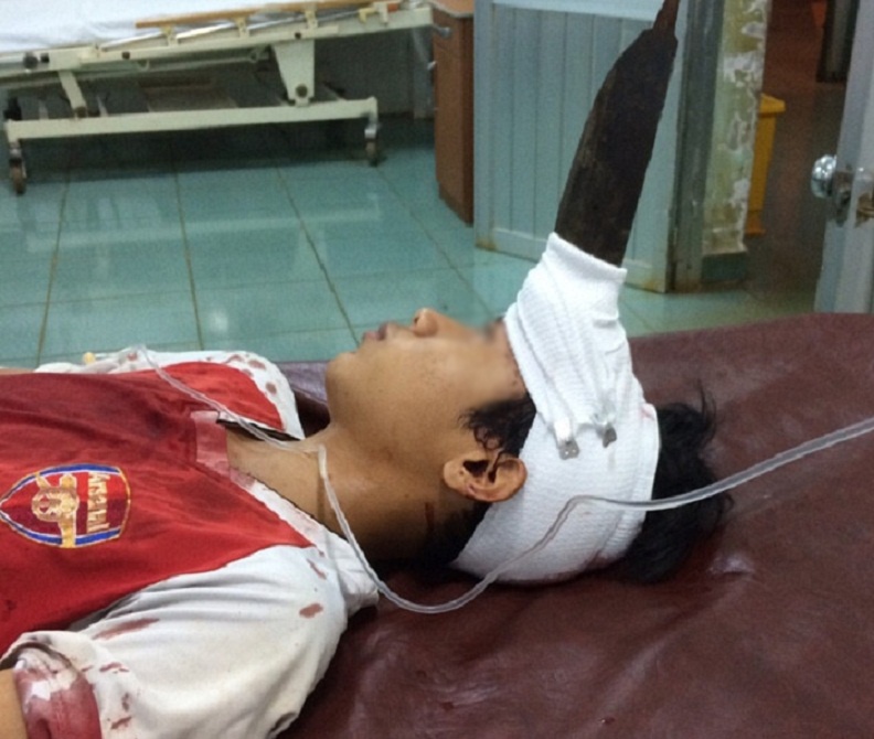 Thieu nien bi dao gam giua tran anh 1