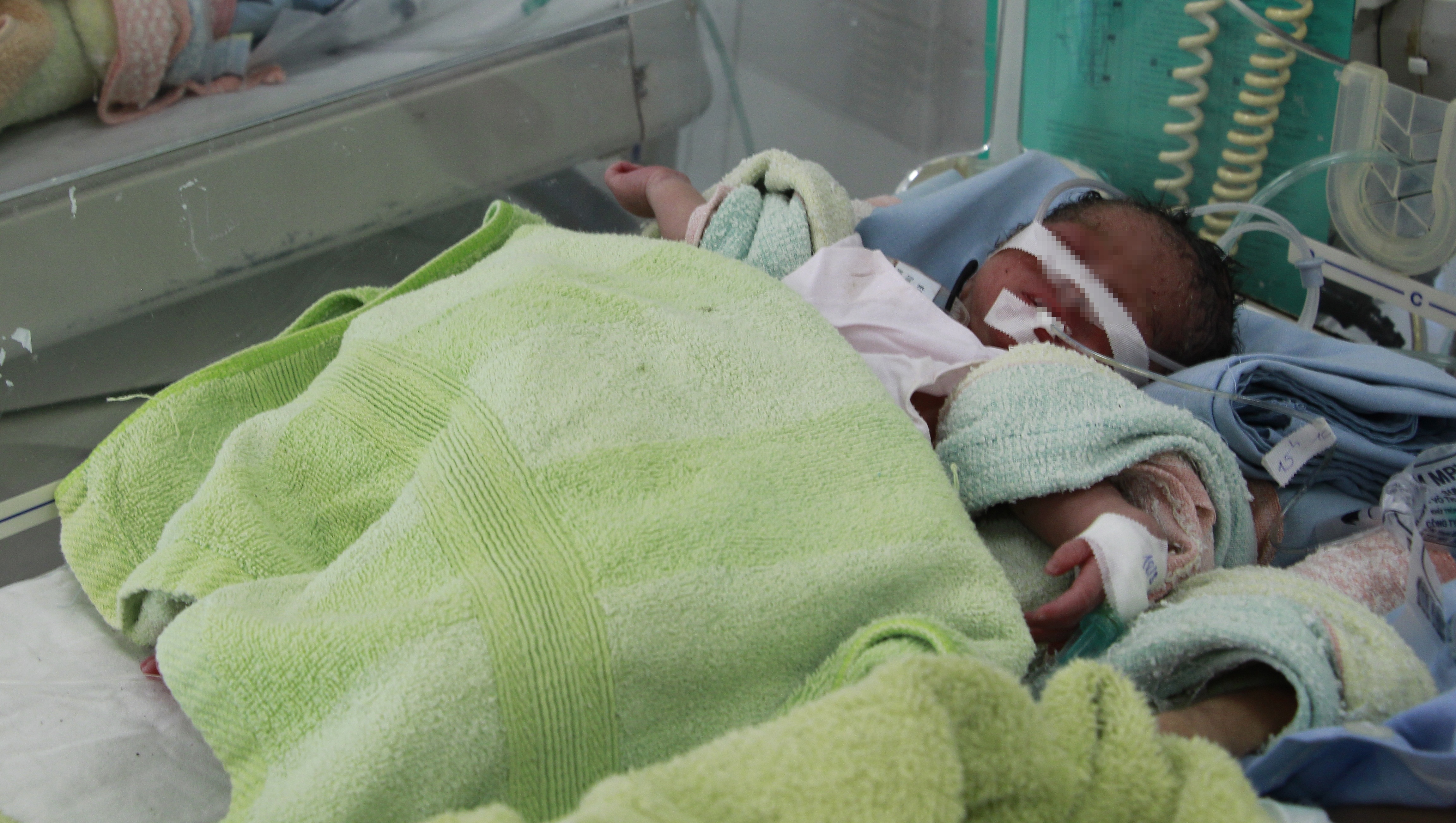 Be gai sinh non bi bo roi trong tui nylon hinh anh