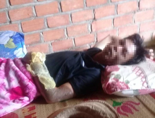 Binh gas mini phat no khien 2 nguoi bi thuong hinh anh