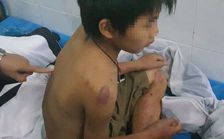 Cau be 11 tuoi di choi bi bo danh nhap vien hinh anh