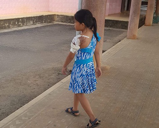 Vo tat nuoc soi chong anh 2