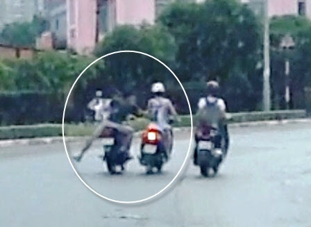 Bi giat tui xach, mot phu nu chan thuong so nao tu vong hinh anh