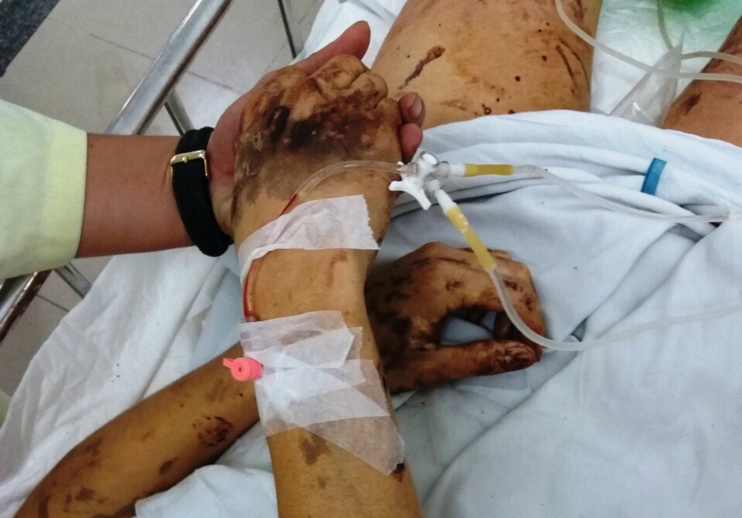 Truy tim thu pham tat axit vao doi ban Viet kieu ve que an Tet hinh anh