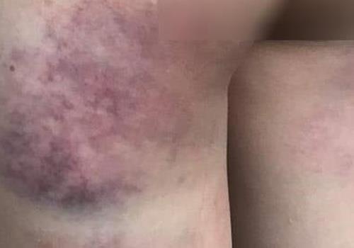 Nu sinh lop 4 bi co giao danh bam mong vi khong lam duoc bai tap hinh anh