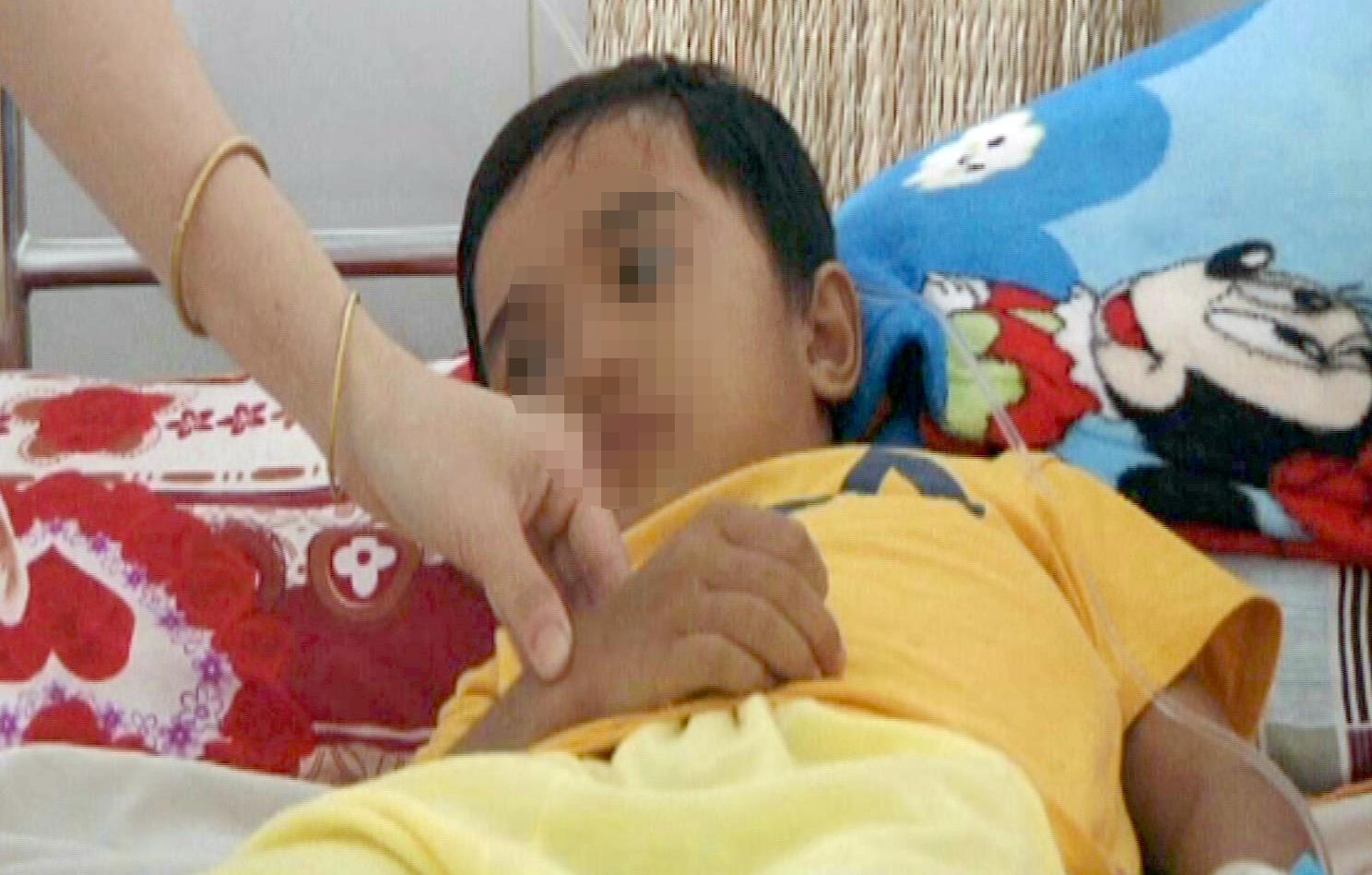 Phau thuat chuyen gioi cho be gai co duong vat hinh anh