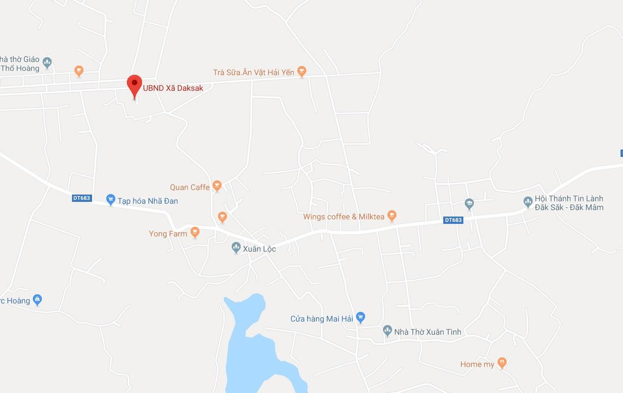 Bé trai 8 tuổi bị điện giật ảnh 1 Be trai 8 tuoi bi dien giat anh 1