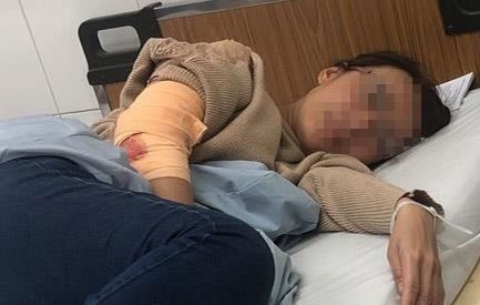 Nu chu quan ca phe bi nhom giang ho chem trong thuong hinh anh