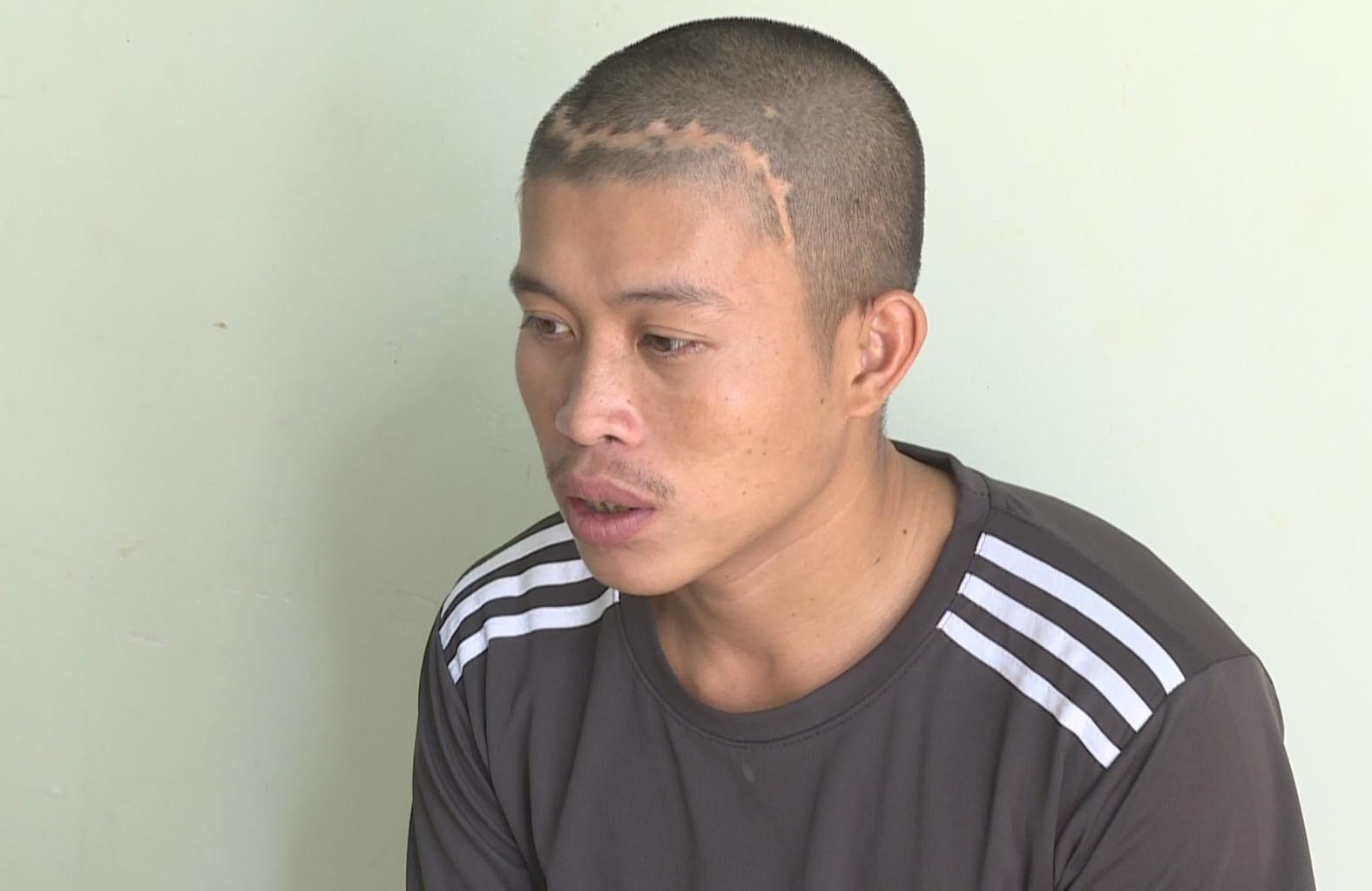 Ten cuop keo le nguoi phu nu deo vang lam gay tay nan nhan hinh anh