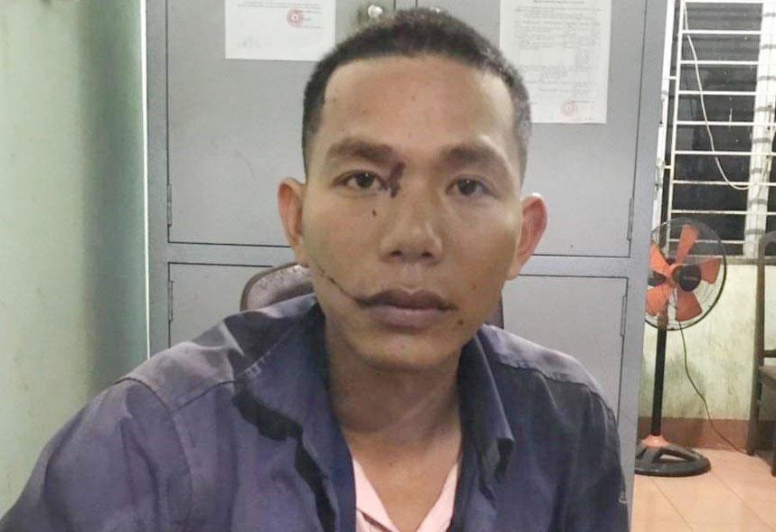 Chem chet tinh dich roi den cong an dau thu hinh anh