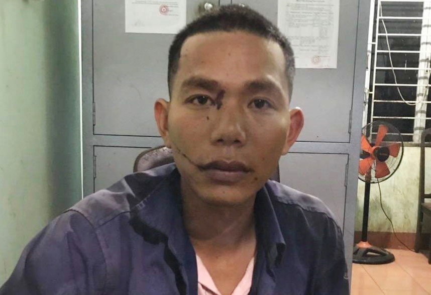 Bat tam giam ke chem chet nguoi tinh cua vo hinh anh