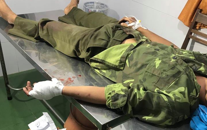 Hon 20 nguoi giai cuu dong bon, chem dut gan tay can bo kiem lam hinh anh