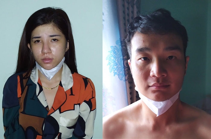 Nhóm thanh niên sử dụng ma túy ảnh 1 Nhom thanh nien su dung ma tuy anh 1