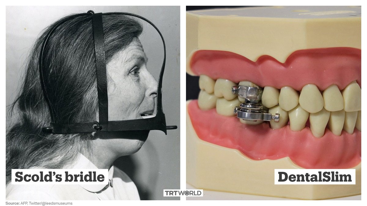 Thiet bi giam can la “khoa” mieng nguoi su dung anh 1