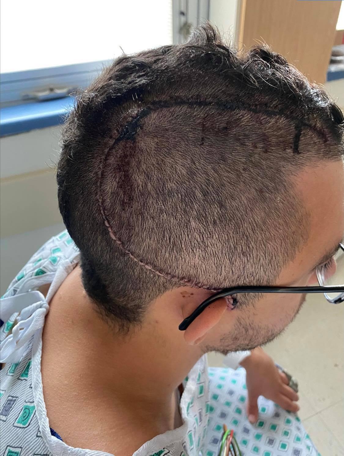 Apple Watch lại cứu người ảnh 1 Apple Watch lai cuu nguoi anh 1