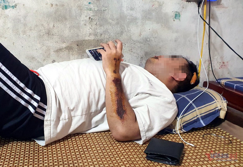 Chu tich Ha Noi: Xu ly nghiem doi tuong ho 'chem chet' o Dan Phuong hinh anh