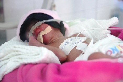 Mo bat con thanh cong cho co gai bi ung thu mau hinh anh