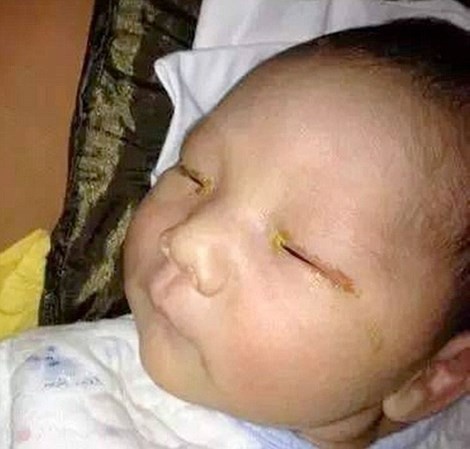 Thuc hu den flash may anh gay mu mat tre so sinh hinh anh